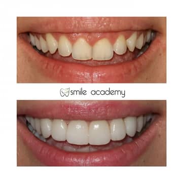 Slider image (4) Esthetic Smile Academy